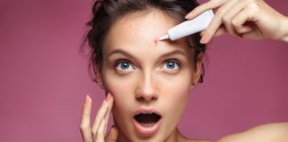 hábitos que você tem que mudar para melhorar a acne