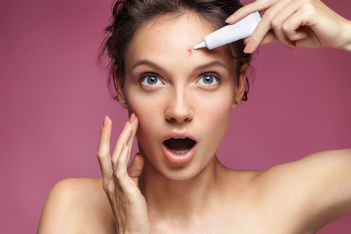 hábitos que você tem que mudar para melhorar a acne