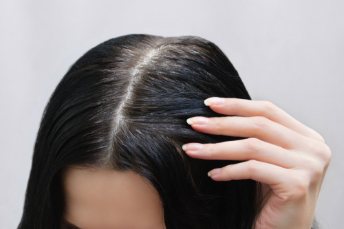 estresse pode deixar seu cabelo branco